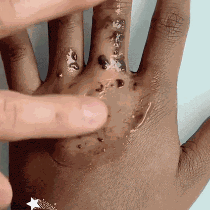 Ellesi´s™ Pore Repair Cream