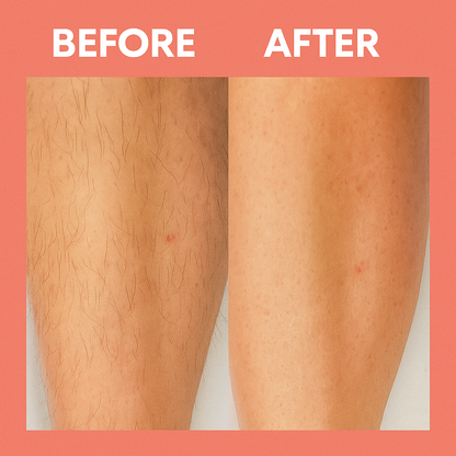LuxeTrim™